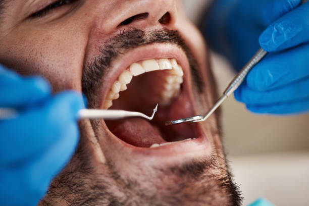 Best Dental Abscess Treatment in Trussville, AL